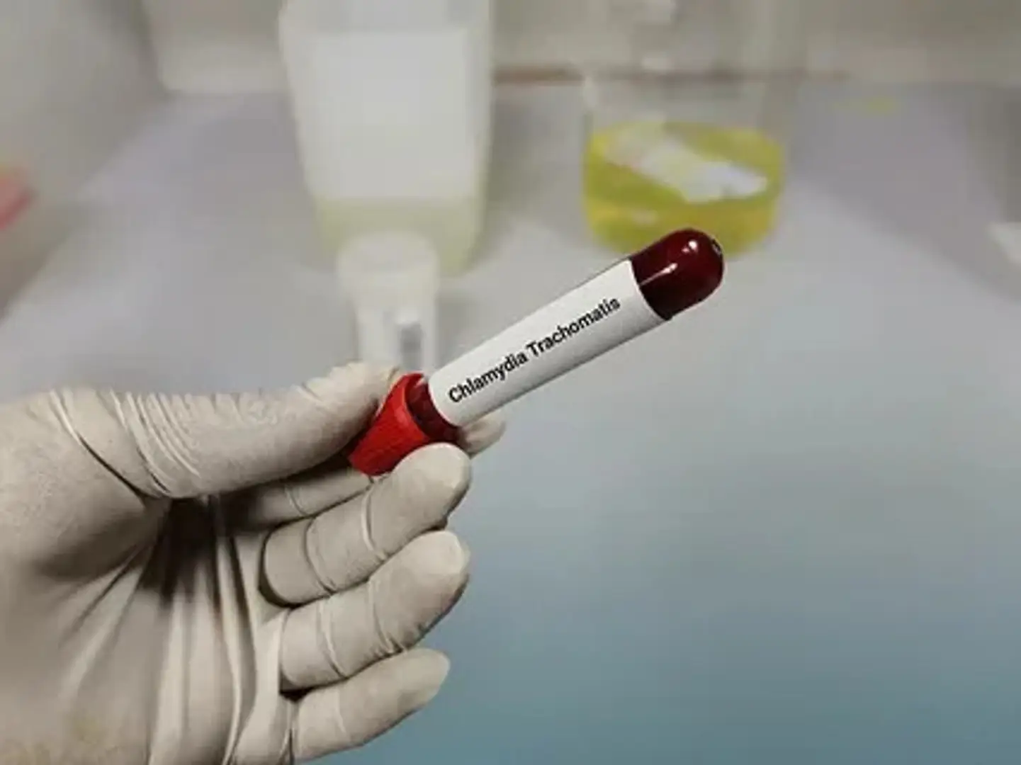 698f0c60c69b5d78da5369b4